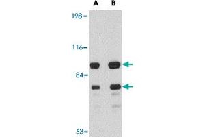 Western blot analysis of DLGAP1 in rat brain tissue lysate with DLGAP1 polyclonal antibody  at (A) 0. (DLGAP1 抗体  (Internal Region))