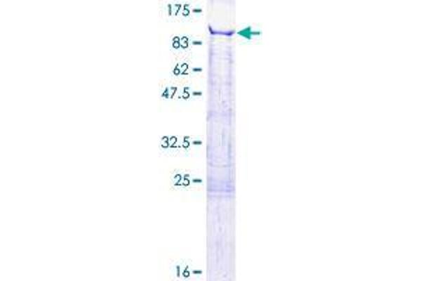 ESRP2 Protein (AA 1-717) (GST tag)