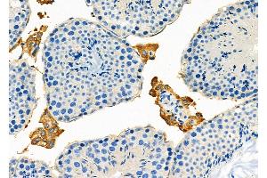 ABIN6265615 and ABIN6273177 at 1/100 staining Mouse testis tissue by IHC-P.