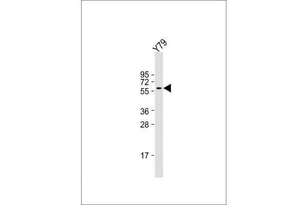 SLC5A12 抗体  (C-Term)