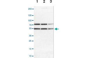 Western blot analysis of Lane 1: NIH-3T3 cell lysate (Mouse embryonic fibroblast cells), Lane 2: NBT-II cell lysate (Rat Wistar bladder tumour cells), Lane 3: PC12 cell lysate (Pheochromocytoma of rat adrenal medulla) with RBM22 polyclonal antibody at 1:100-1:500 dilution.