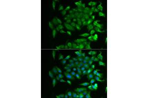 Immunofluorescence analysis of MCF-7 cells using RBP2 antibody (ABIN5974059). (RBP2 抗体)