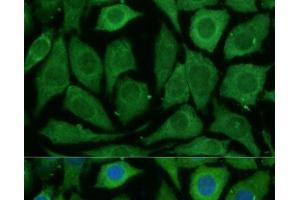 Immunofluorescence analysis of L929 cells using SARDH Polyclonal Antibody at dilution of 1:100 (40x lens). (SARDH 抗体)