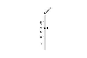 Anti-IGHG1 Antibody (Center) at 1:2000 dilution + human plasma lysate Lysates/proteins at 20 μg per lane. (IGHG1 抗体  (AA 154-180))
