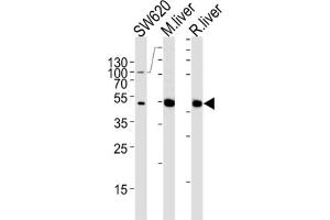 Western Blotting (WB) image for anti-Ornithine Carbamoyltransferase (OTC) antibody (ABIN3002885) (OTC 抗体)