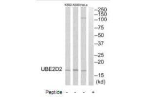 Western blot analysis of extracts from HeLa cells, A549 cells and K562 cells, using UBE2D2 antibody. (UBE2D2 抗体  (C-Term))