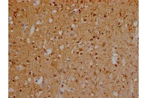IHC image of ABIN7127835 diluted at 1:100 and staining in paraffin-embedded human brain tissue performed on a Leica BondTM system. (Recombinant MAPT 抗体)