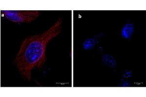 Immunofluorescence of α-tubulin using 680-conjugated Fluorescent anti-mouse IgG Immunofluorescence microscopy of α-tubulin in HeLa cells using 680-conjugated Fluorescent anti-mouse IgG  for detection. (Fluorescent TrueBlot®: Anti-小鼠 Ig DyLight™ 680)