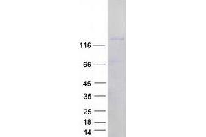 Western Blotting (WB) image for Transcription Elongation Factor SPT5 (SUPT5H) (Transcript Variant 1) protein (Myc-DYKDDDDK Tag) (ABIN2733007)