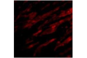 Immunofluorescence of PDL-1 in Human Heart cells with PDL-1at 20 ug/ml. (PD-L1 抗体  (Center))