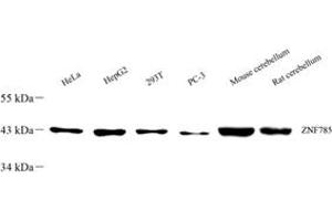 Western blot analysis of ZNF785 (ABIN7076274) at dilution of 1: 500 (ZNF785 抗体)