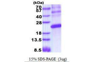 Figure annotation denotes ug of protein loaded and % gel used. (ESM1 蛋白)