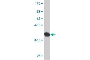Western Blot detection against Immunogen (37. (CPXM1 抗体  (AA 610-718))