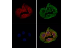 ABIN7094585 and ABIN7098634 staining Hela cells by IF/ICC.