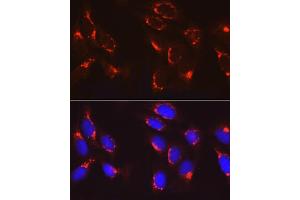 Immunofluorescence analysis of U2OS cells using COPB2 Rabbit pAb (ABIN6129253, ABIN6138871, ABIN6138872 and ABIN6222818) at dilution of 1:100 (40x lens). (COPB2 抗体  (AA 657-906))