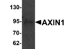 Western Blotting (WB) image for anti-Axin 1 (AXIN1) (C-Term) antibody (ABIN1030273) (Axin 抗体  (C-Term))