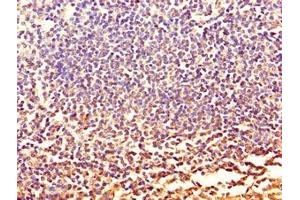 Immunohistochemistry of paraffin-embedded human tonsil tissue using ABIN7146099 at dilution of 1:100 (CXCR2 抗体  (AA 1-40))