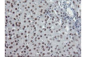 Image no. 2 for anti-TP53RK Binding Protein (TPRKB) antibody (ABIN1501484) (TPRKB 抗体)
