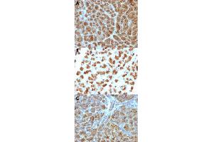 Immunohistochemical staining (Formalin-fixed paraffin-embedded sections) of human pancreas (A), rat pancreas (B) and mouse pancreas (C) with ELA3B monoclonal antibody, clone CELA3B/1257 . (Elastase 3B 抗体  (AA 82-238))