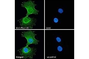 (ABIN185358) Immunofluorescence analysis of paraformaldehyde fixed HeLa cells, permeabilized with 0. (PLXND1 抗体  (Internal Region))