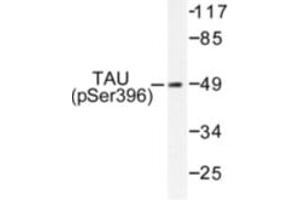 Image no. 1 for anti-Microtubule-Associated Protein tau (MAPT) (pSer396) antibody (ABIN318142) (MAPT 抗体  (pSer396))
