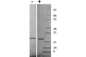 SDS-PAGE of Human Sonic Hedgehog Recombinant Protein SDS-PAGE of Human Sonic Hedgehog Recombinant Protein. (Sonic Hedgehog Protein (SHH))