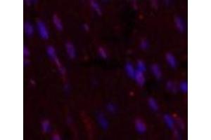 Immunofluorescence analysis of Mouse heart tissue using CD5 Monoclonal Antibody at dilution of 1:200. (CD5 抗体)
