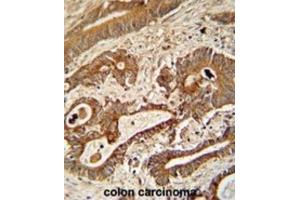 Immunohistochemistry (IHC) image for anti-Ethylmalonic Encephalopathy 1 (ETHE1) antibody (ABIN3002726) (ETHE1 抗体)