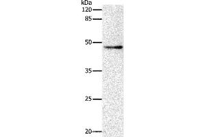 Western blot analysis of Hela cell, using DRD1 Polyclonal Antibody at dilution of 1:500 (Dopamine Receptor d1 抗体)