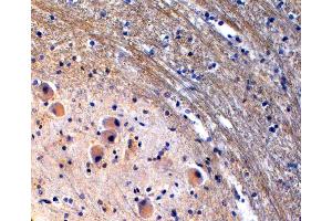 (ABIN185533) (2 μg/mL) staining of paraffin embedded Human Brain Stem. (Tryptophan Hydroxylase 2 抗体  (Internal Region))