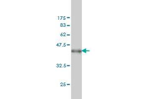 Western Blot detection against Immunogen (38. (MAPK13 抗体  (AA 251-365))