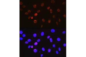 anti-Cyclin H (CCNH) antibody