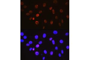 Immunofluorescence analysis of NIH-3T3 cells using Cyclin H Rabbit mAb (ABIN7266569) at dilution of 1:100 (40x lens). (Cyclin H 抗体)