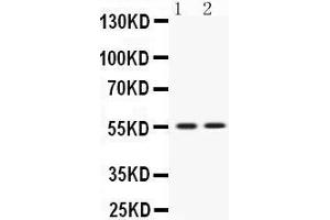 Western blot analysis of VRK1 expression in rat thymus extract (lane 1) and JURKAT whole cell lysates (lane 2). (VRK1 抗体  (C-Term))