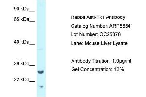Western Blotting (WB) image for anti-Thymidine Kinase 1, Soluble (TK1) (Middle Region) antibody (ABIN2787731) (TK1 抗体  (Middle Region))