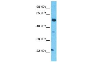 Host:  Rabbit  Target Name:  TCEAL5  Sample Type:  Thymus Tumor lysates  Antibody Dilution:  1. (TCEAL5 抗体  (Middle Region))