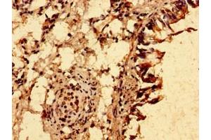 Immunohistochemistry of paraffin-embedded human lung tissue using ABIN7151248 at dilution of 1:100 (TRIM21 抗体  (AA 1-475))