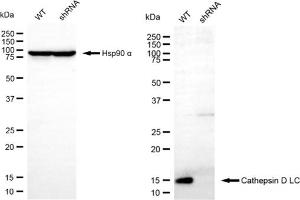 Western blotting analysis using cathepsin D LC antibody (ABIN7797939).