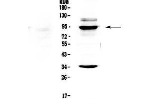 Western blot analysis of BRD7 using anti-BRD7 antibody . (BRD7 抗体  (AA 514-567))
