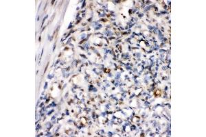 IHC analysis of ZEB1 using anti-ZEB1 antibody (ABIN7602984). (ZEB1 抗体  (Middle Region))