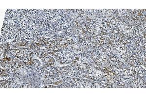 IHC analysis of DGKZ/DGK-zeta using anti-DGKZ/DGK-zeta antibody (ABIN7602261).