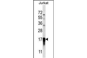 Western blot analysis in Jurkat cell line lysates (35ug/lane). (PFDN5 抗体  (AA 79-108))