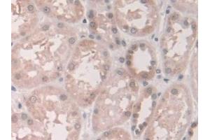 Immunohistochemistry (IHC) image for anti-Grancalcin, EF-Hand Calcium Binding Protein (GCA) (AA 1-139) antibody (ABIN7444166)