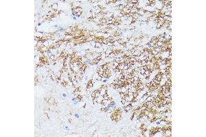 Immunohistochemistry of paraffin-embedded mouse spinal cord using CTNN antibody (ABIN7266134) at dilution of 1:100 (40x lens). (CTNNA2 抗体  (AA 150-300))