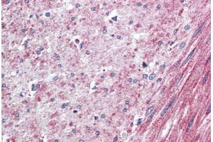 Human Colon, Smooth Muscle (formalin-fixed, paraffin-embedded) stained with ELTD1 antibody ABIN410769 followed by biotinylated goat anti-rabbit IgG secondary antibody ABIN481713, alkaline phosphatase-streptavidin and chromogen. (ELTD1 抗体  (N-Term))