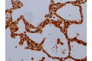 Immunohistochemistry (IHC) image for anti-Tubulin, beta (TUBB) (AA 170-419) antibody (ABIN7428962)