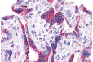 Human Placenta: Formalin-Fixed, Paraffin-Embedded (FFPE) (DLL1 抗体  (N-Term))