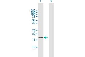 Western Blot analysis of EIF5A2 expression in transfected 293T cell line by EIF5A2 MaxPab polyclonal antibody. (EIF5A2 抗体  (AA 1-153))