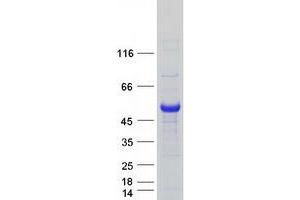 Western Blotting (WB) image for Eukaryotic Translation Initiation Factor 2B, Subunit 3 Gamma, 58kDa (EIF2B3) protein (Myc-DYKDDDDK Tag) (ABIN2720068)