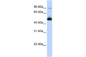 WB Suggested Anti-KRT16 Antibody Titration: 0. (KRT16 抗体  (Middle Region))